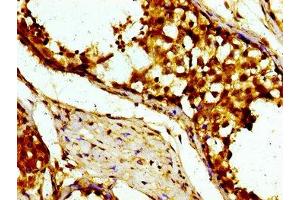 Immunohistochemistry (IHC) image for anti-Ubiquitin Specific Peptidase 1 (USP1) (AA 453-592) antibody (ABIN7174250)