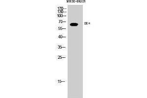 Western Blotting (WB) image for anti-Estrogen Receptor 1 (ESR1) (Ser363) antibody (ABIN3184553) (Estrogen Receptor alpha 抗体  (Ser363))