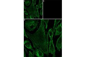 Unlabeled α-Conotoxin GI successfully blocks α-Conotoxin GI-ATTO Fluor-647N binding.