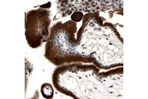 Immunohistochemical staining of human placenta with C3orf63 polyclonal antibody  shows strong cytoplasmic positivity in trophoblastic cells at 1:500-1:1000 dilution. (FAM208A 抗体)