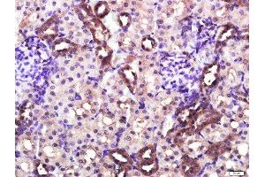Immunohistochemistry (Paraffin-embedded Sections) (IHC (p)) image for anti-CD4 (CD4) (AA 385-457) antibody (ABIN671376)