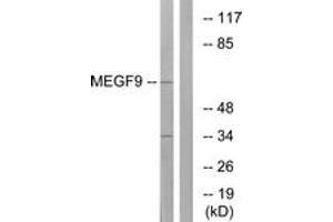 Western blot analysis of extracts from COLO cells, using MEGF9 Antibody. (MEGF9 抗体  (AA 383-432))