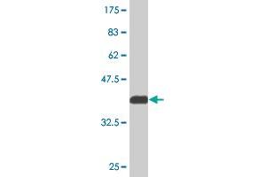 Western Blot detection against Immunogen (36. (PXK 抗体  (AA 351-450))