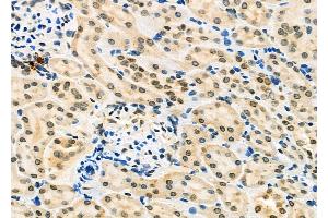 ABIN6262571 and ABIN6277224 at 1/100 staining Rat kidney tissue by IHC-P. (Interleukin enhancer-binding factor 3 (ILF3) (Internal Region) 抗体)