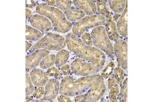 Immunohistochemistry of paraffin-embedded mouse kidney using FKBP6 antibody at dilution of 1:100 (x400 lens). (FKBP6 抗体)