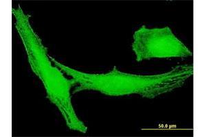 Immunofluorescence of purified MaxPab antibody to LRRC23 on HeLa cell. (LRRC23 抗体  (AA 1-343))
