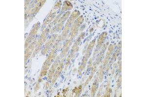 Immunohistochemistry of paraffin-embedded mouse stomach using RARS2 antibody (ABIN5974692) at dilution of 1/100 (40x lens). (RARS2 抗体)