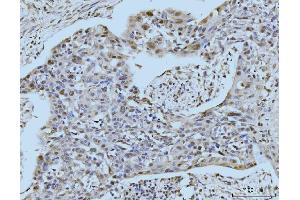 IHC analysis of SBNO1 using anti-SBNO1 antibody (ABIN7601710). (SBNO1 抗体  (AA 43-1303))