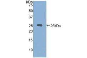Detection of Recombinant CHRD, Mouse using Polyclonal Antibody to Chordin (CHRD) (Chordin 抗体  (AA 422-635))