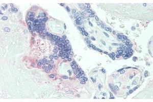 Detection of PLGF in Human Placenta Tissue using Polyclonal Antibody to Placenta Growth Factor (PLGF) (PLGF 抗体  (AA 24-158))