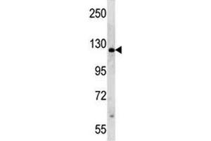 PARP antibody western blot analysis in HeLa lysate (PARP1 抗体  (AA 183-214))