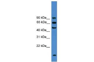 WB Suggested Anti-UMOD Antibody Titration:  0. (Uromodulin 抗体  (C-Term))