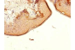 Immunohistochemistry of paraffin-embedded human skin tissue using ABIN7147366 at dilution of 1:100 (CENPK 抗体  (AA 1-269))
