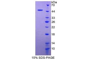 SDS-PAGE (SDS) image for Claudin 1 (CLDN1) (AA 50-197) protein (His tag,GST tag) (ABIN1981083) (Claudin 1 Protein (CLDN1) (AA 50-197) (His tag,GST tag))