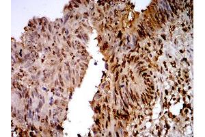 Immunohistochemistry (IHC) image for anti-Transcription Termination Factor, RNA Polymerase I (TTF1) (AA 1-150) antibody (ABIN5871603) (TTF1 抗体  (AA 1-150))