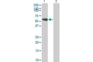 Western Blot analysis of FYN expression in transfected 293T cell line by FYN monoclonal antibody (M01), clone 3G11-F9. (FYN 抗体  (AA 1-482))