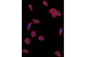 Immunofluorescent analysis of VEGFR2 (pY1214) staining in MCF cells. (VEGFR2/CD309 抗体  (C-Term, pTyr1214))
