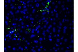 Immunohistochemistry (IHC) image for anti-Phosphoinositide 3 Kinase, p85 alpha (PI3K p85a) (pTyr607) antibody (ABIN6256775)