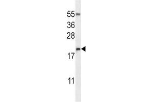 Western Blotting (WB) image for anti-Eosinophil Cationic Protein (ECP) antibody (ABIN2997398) (RNASE3 抗体)