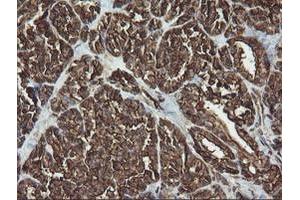 Image no. 2 for anti-RAB30, Member RAS Oncogene Family (RAB30) antibody (ABIN1500558) (RAB30 抗体)