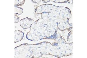Immunohistochemistry of paraffin-embedded human placenta using CLUH antibody  at dilution of 1:100 (40x lens). (CLUH 抗体  (AA 1120-1309))