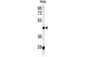 Western blot analysis of CHN2 (arrow) in Hela cell line lysates (35ug/lane) using ARHGAP3/CHN2  (CHN2 抗体  (Middle Region))