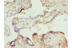 Immunohistochemistry of paraffin-embedded human placenta tissue using ABIN7156320 at dilution of 1:100 (ITPK1 抗体  (AA 185-414))