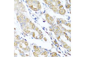 Immunohistochemistry of paraffin-embedded human stomach using DARS2 antibody (ABIN5975194) at dilution of 1/100 (40x lens). (DARS2 抗体)
