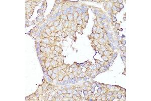 Immunohistochemistry of paraffin-embedded mouse testis using MME antibody. (MME 抗体  (AA 52-352))