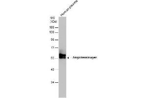WB Image Human tissue extract (30 μg) was separated by 10% SDS-PAGE, and the membrane was blotted with Angiotensinogen antibody [N1C3] , diluted at 1:500. (AGT 抗体)