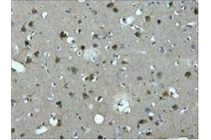 IHC staining of Human brain tissue paraffin-embedded, diluted at 1:200. (MAP2 抗体)