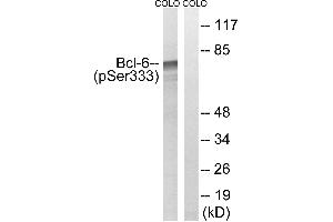 Western blot analysis of extracts from COLO cells, treated with insulin (0. (BCL6 抗体  (pSer333))