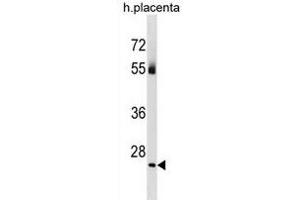 TBC1D26 Antibody (C-term) (ABIN1881871 and ABIN2838991) western blot analysis in human placenta tissue lysates (35 μg/lane). (TBC1D26 抗体  (C-Term))