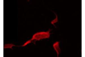 ABIN6274388 staining HeLa by IF/ICC. (ADCK5 抗体  (N-Term))