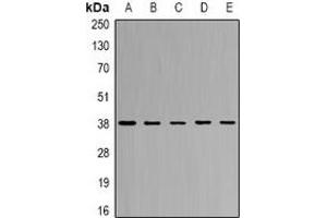 Western blot analysis of CapG expression in SW620 (A), THP1 (B), mouse lung (C), mouse spleen (D), rat heart (E) whole cell lysates. (CAPG 抗体)