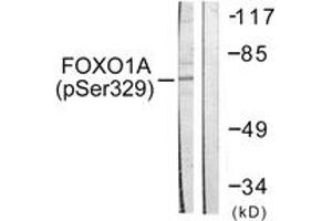Western blot analysis of extracts from HeLa cells treated with Serum 20% 15', using FOXO1A (Phospho-Ser329) Antibody. (FOXO1 抗体  (pSer329))