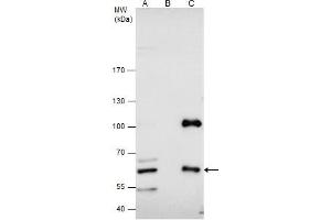 Immunoprecipitation (IP) image for anti-Cystathionine-beta-Synthase (CBS) antibody (ABIN2856898)