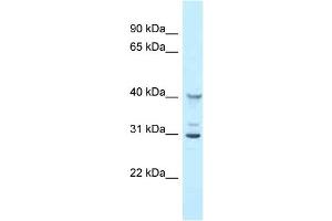 WB Suggested Anti-Oas1g Antibody Titration: 1. (OAS1G 抗体  (N-Term))