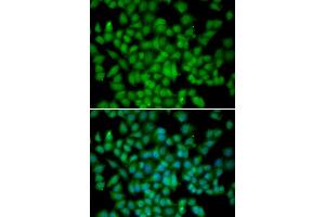Immunofluorescence analysis of HeLa cells using CDKN2C antibody. (CDKN2C 抗体)