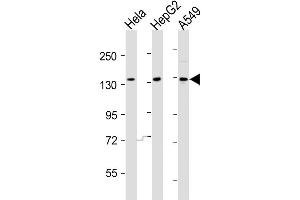 Western Blot at 1:2000 dilution Lane 1: Hela whole cell lysates Lane 2: HepG2 whole cell lysates Lane 3: A549 whole cell lysates Lysates/proteins at 20 ug per lane. (AATK 抗体  (N-Term))