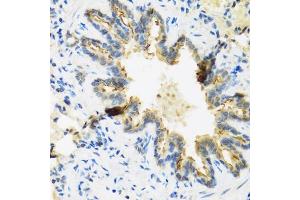 Immunohistochemistry of paraffin-embedded rat lung using DEFB4A antibody (ABIN3015538, ABIN3015539, ABIN3015540 and ABIN6218726) at dilution of 1:100 (40x lens). (DEFB4A 抗体  (AA 1-64))