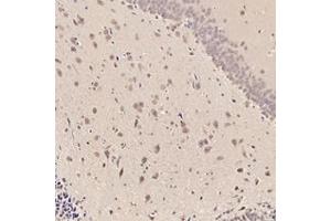 Immunohistochemistry analysis of paraffin-embedded rat striatum using,RMND5A (ABIN7075401) at dilution of 1: 3000 (RMND5A 抗体)