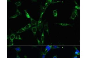 Immunofluorescence analysis of NIH-3T3 cells using BUB1B Polyclonal Antibody at dilution of 1:100. (BUB1B 抗体)