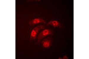 Immunofluorescent analysis of p38 staining in HeLa cells. (MAPK14 抗体  (Center))