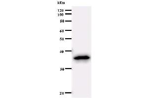 Western Blotting (WB) image for anti-Sex Comb On Midleg-Like 2 (SCML2) antibody (ABIN933093) (SCML2 抗体)