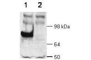 WB - Dab1 Antibody  Immunochemical's anti-Dab1 is shown to detect Dab1 present in wt mouse brain extracts (lane 1). (DAB1 抗体  (AA 400-555))