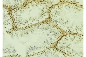 ABIN6277185 at 1/100 staining Mouse testis tissue by IHC-P. (IFIH1 抗体  (C-Term))