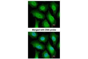 ICC/IF Image Immunofluorescence analysis of paraformaldehyde-fixed HeLa, using FACA, antibody at 1:200 dilution. (FANCA 抗体  (N-Term))