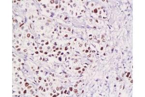 Immunohistochemistry (Paraffin-embedded Sections) (IHC (p)) image for anti-Zinc Finger and BTB Domain Containing 7A (ZBTB7A) (AA 151-250) antibody (ABIN729448)
