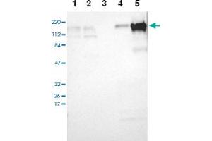 Western blot analysis of Lane 1: RT-4, Lane 2: U-251 MG, Lane 3: A-431, Lane 4: Liver, Lane 5: Tonsil with TJP2 polyclonal antibody at 1:100-1:250 dilution. (TJP2 抗体)